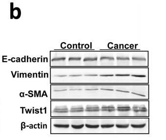 Twist1 Antibody - (b) Te expression of E-cadherin, vimentin, α-SMA and twist1 at protein level was shown by Western blot.