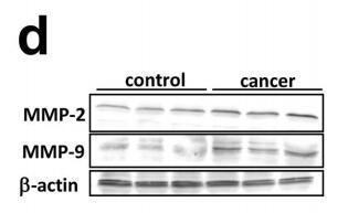 MMP2 Antibody - (d) Te expression of MMP2 and MMP9 at protein level was shown by Western blot.
