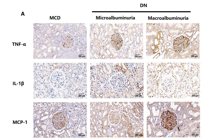 IL1 beta Antibody - Fig.