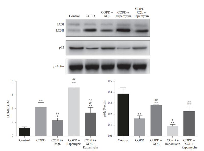SQSTM1/p62 Antibody - Figure 4: |Western blotting of LC3I, LC3II, p62, and β-actin.