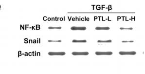 NF-kB p65 Antibody - Fig.