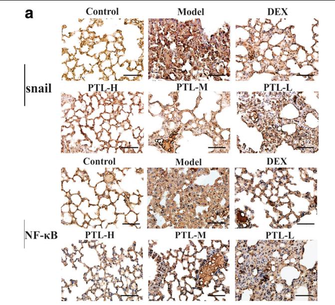 NF-kB p65 Antibody - Fig.