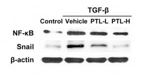 beta Actin Antibody - Fig.