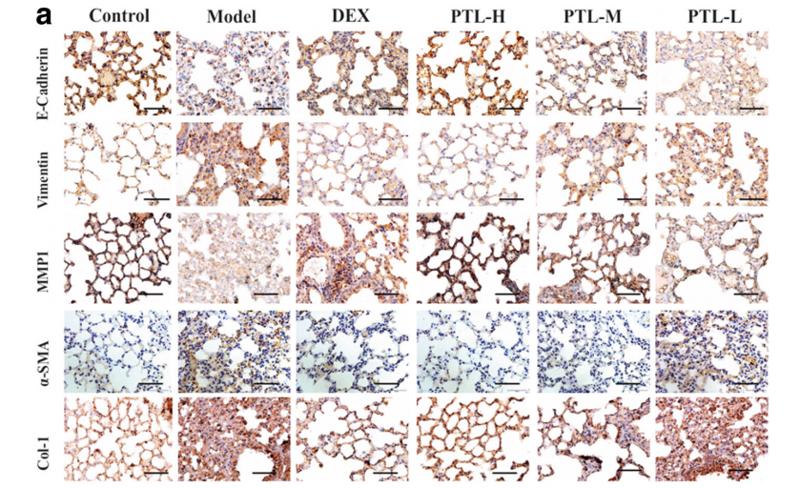 Collagen I Antibody - Fig.