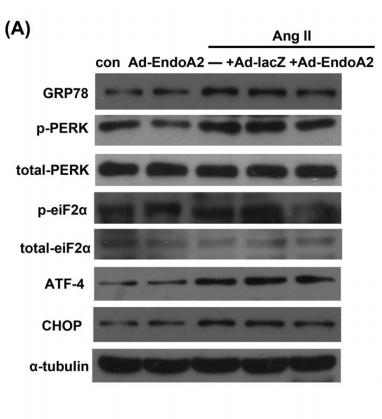 DDIT3/CHOP Antibody - FIGURE 4| EndoA2 modulated the MAPK signaling pathway in response to ERS.