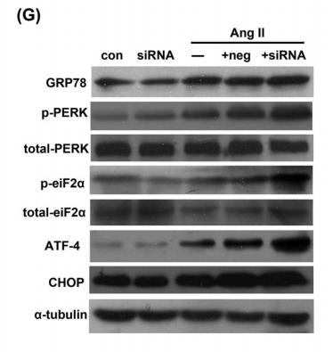 PERK Antibody - FIGURE 4| EndoA2 modulated the MAPK signaling pathway in response to ERS.