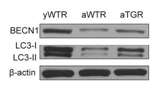LC3A/B Antibody - Figure 4 | Immunohistochemistry and western blotting analysis of the levels of autophagy.