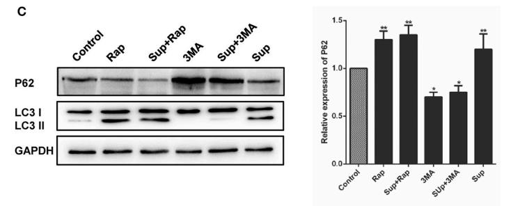 LC3A/B Antibody - FIGURE 6 | Autophagy did not affect neurite outgrowth in PC12 cells.