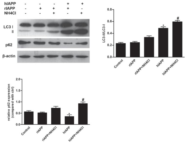 SQSTM1/p62 Antibody - Figure 1.