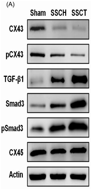 TGF beta 1 Antibody - FIGURE 2 |Changes in CX43, pCX43, TGF-β1, Smad3, pSmad3, and CX45 levels examined by Western blot in detrusor after sacral spinal injury.