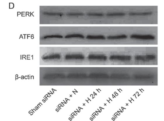 PERK Antibody - Figure 2.