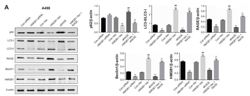 Beclin 1 Antibody - Figure 4| HMGB1 regulated RAGE and autophagic protein expressions in human RCC cell lines.