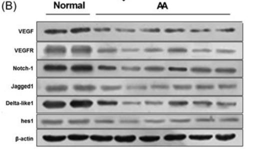 VEGFA Antibody - FIGURE 1| The expression of VEGF‐Notch signaling pathway related factors (VEGF, VEGFR, Notch‐1, Jagged1, Delta‐like1, and hes1) in AA patients with KB (n = 3).