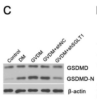 GSDMD Antibody - Fig.