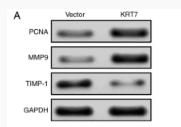 MMP9 Antibody - Figure 5.