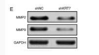 MMP2 Antibody - Figure 5.