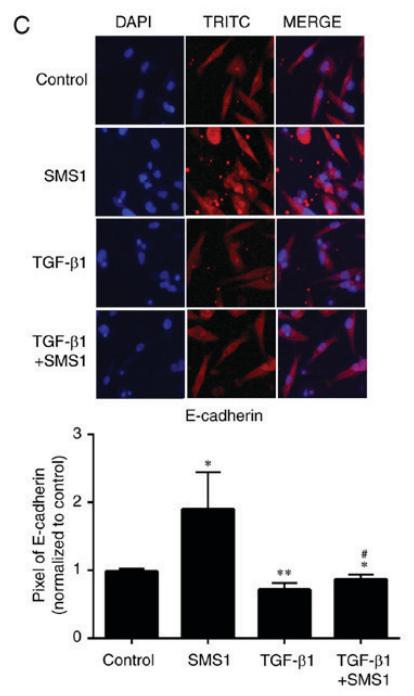 TGFBR1 Antibody - Figure 3.