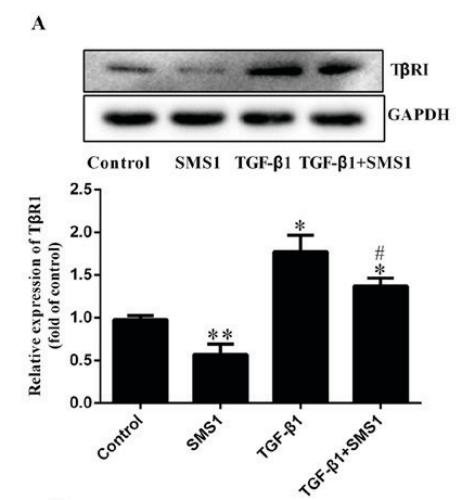 TGFBR1 Antibody - Figure 4.