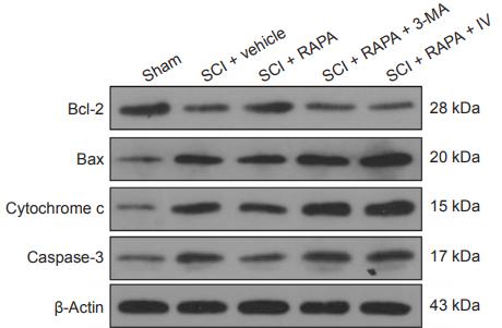 Bcl-2 Antibody - Figure 7| Expression of Bcl-2, Bax, cytochrome c and caspase-3 protein in the dorsal column at 24 hours after SCI.