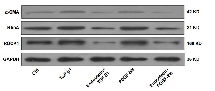 GAPDH Antibody - Figure 5 | Endostatin inhibits the expressions of α-SMA, RhoA, and ROCK1 at protein level.