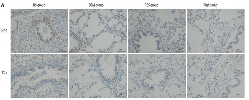 NF-kB p65 Antibody - Figure 3.
