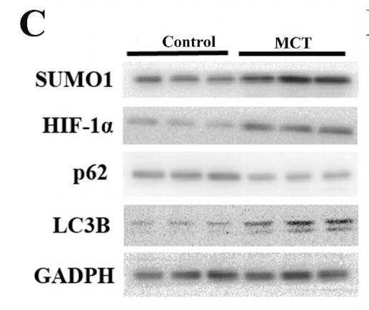 SQSTM1/p62 Antibody - Fig.