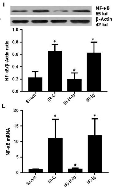 NF-kB p65 Antibody - FIGURE 3|High‐mobility group protein box‐1 (HMGB1) antibody attenuates myocardial injury through mediating the role of dendritic cells (DCs) regulated by the HMGB1‐TLR4 signalling pathway.