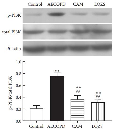 PI3K p85 alpha Antibody - Figure 4:| Efect of LQZS on phosphorylation levels of EGFR, PI3K, and AKT in lung tissues of rats with AECOPD.