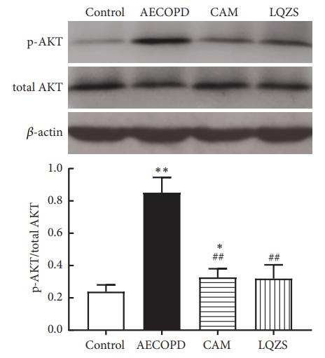 Phospho-AKT1/2/3 (Ser473) Antibody - Figure 4:| Efect of LQZS on phosphorylation levels of EGFR, PI3K, and AKT in lung tissues of rats with AECOPD.