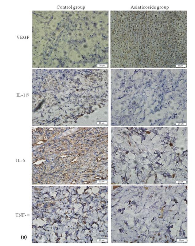 IL6 Antibody - FIGURE 6| (a) Immunohistochemical evaluation of vascular endothelial growth factor (VEGF),TNF-a, IL-6, and IL-1b in Zone 2 of the two groups, observed under original magnification 400.