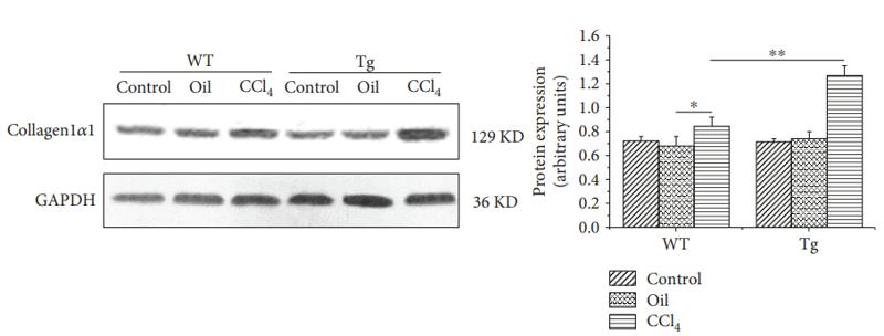 Collagen I Antibody - Figure 3:| Constitutive TL1A expression on myeloid cells exacerbated liver fibrosis.