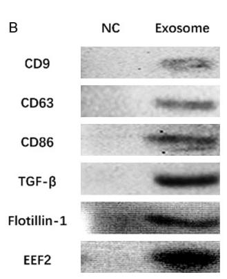 TGF beta 1 Antibody - Figure 1.