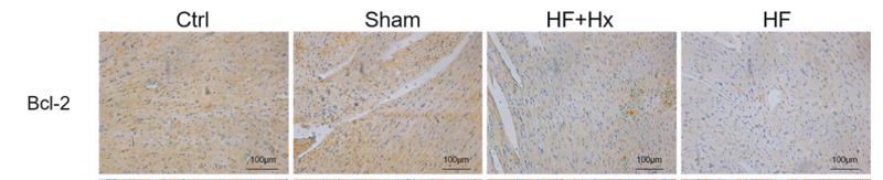 Bcl-2 Antibody - Figure 4.