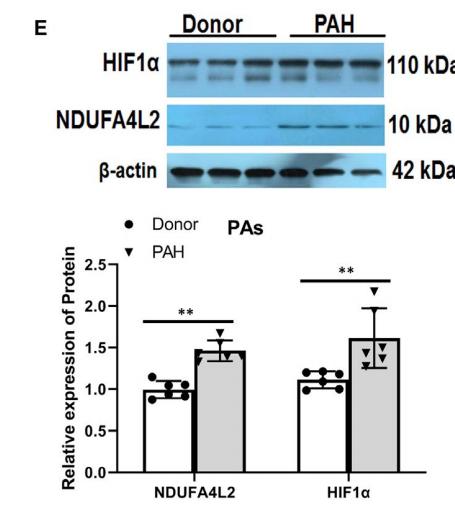 HIF1A Antibody - FIGURE 2 NDUFA4L2 expression 
was increased in the PAs of PAH patients 
and hypoxic PAH model rats.