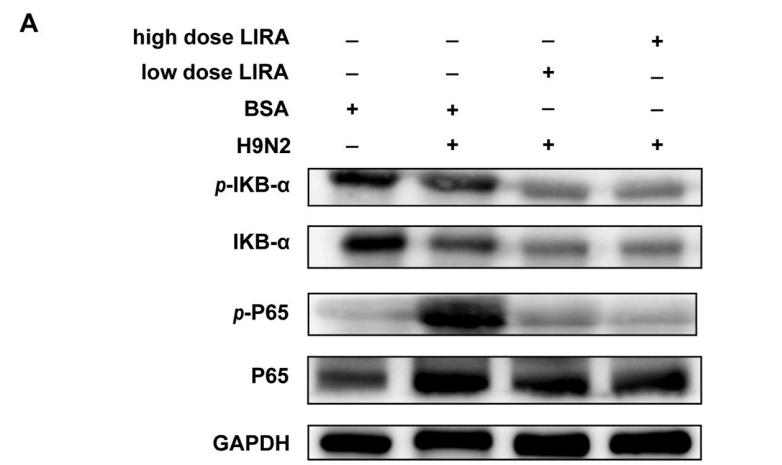 NF-kB p65 Antibody - Fig.