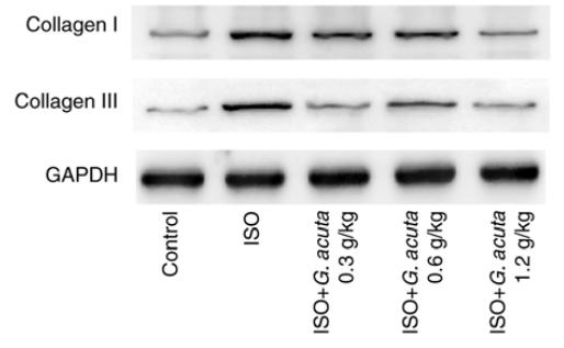 Collagen I Antibody - Figure 3.