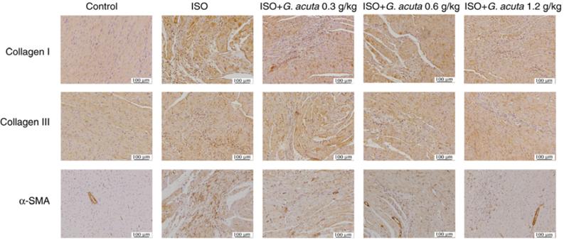 Collagen I Antibody - Figure 3.