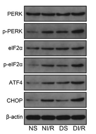 DDIT3/CHOP Antibody - Figure 3.