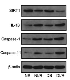 Caspase 1 Antibody - Figure 4.