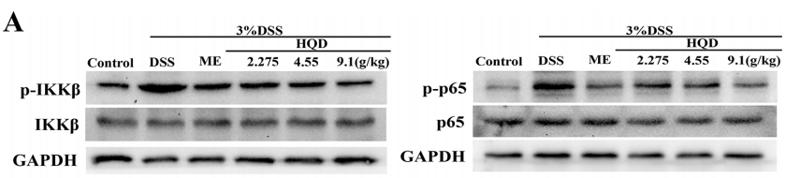 NF-kB p65 Antibody - FIGURE 7 | Effects of Huangqin decoction (HQD) on colonic expression levels of nuclear factor-kappa B (NF-kB) pathway proteins assessed by Western blot in dextran sulfate sodium (DSS)-induced colitis mice (A).