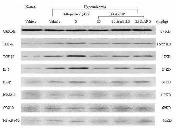 TGF beta 1 Antibody - Figure 4.