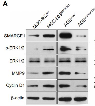ERK1/2 Antibody - Figure 7| SMARCE1 increases GC cell proliferation, migration, and invasion via activation of the MAPK/ERK signaling pathway.