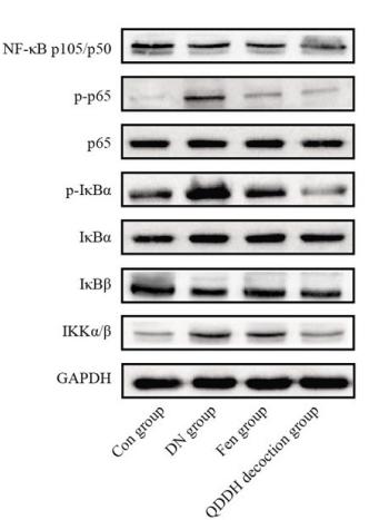 NF-kB p65 Antibody - Figure 4.