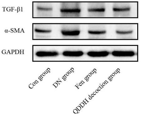 TGF beta 1 Antibody - Figure 5.