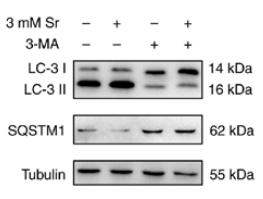 SQSTM1/p62 Antibody - Figure 3.