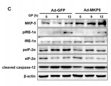 Phospho-IRE1 (Ser724) Antibody - Fig.