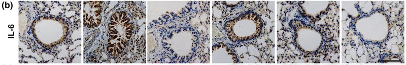 IL6 Antibody - FIGURE 7 |Total flavonoids from sea buckthorn fruit (TFSB) treatment suppressed the expression of cytokines, chemokines, and MUC5AC in bronchial tissues in lipopolysaccharide/cigarette smoke extract (LPS/CS)‐exposed mice.