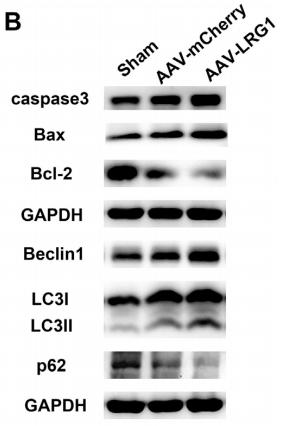SQSTM1/p62 Antibody - Fig.