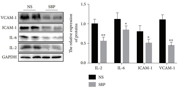 IL6 Antibody - Figure 5:| The inhibitory roles of SBP in vascular inflammation.