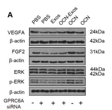 ERK1/2 Antibody - Figure 6| OCN effected cell function of endothelial cells.